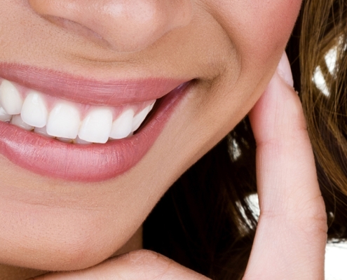 Woman Smiling Great Teeth Whitening